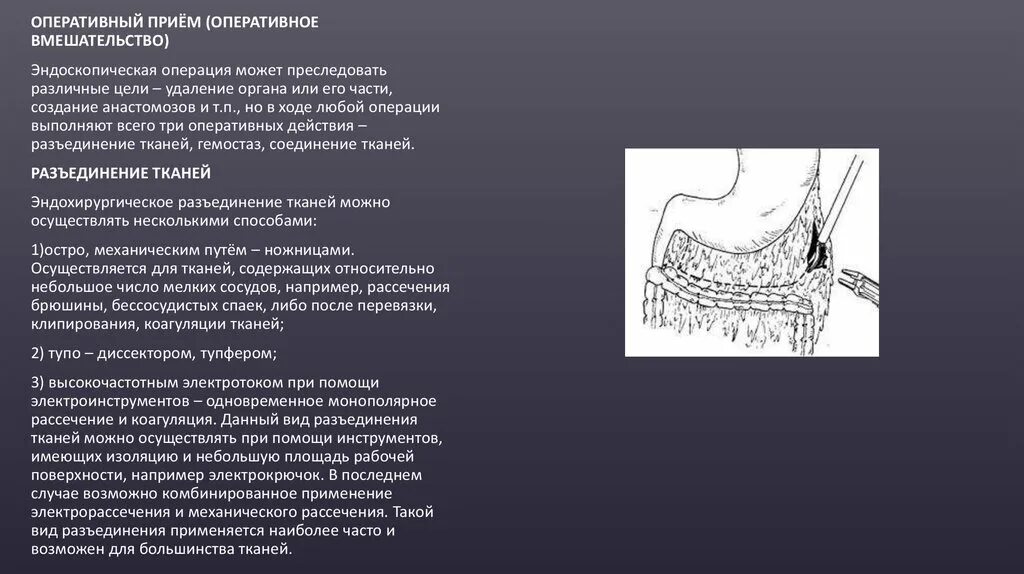 Операции выполняемые руками. Основные оперативные приемы в хирургии. оперативный прием в хирургии. этапы эндоскопической операции. осложнения видеоэндоскопической хирургии.