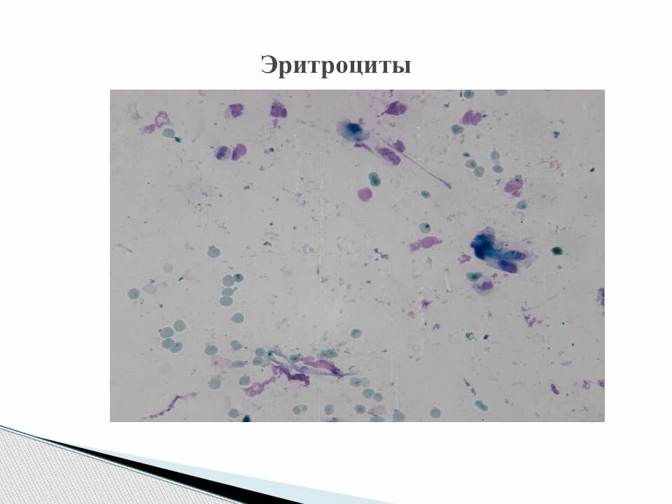 Микроскопическое исследование назального секрета