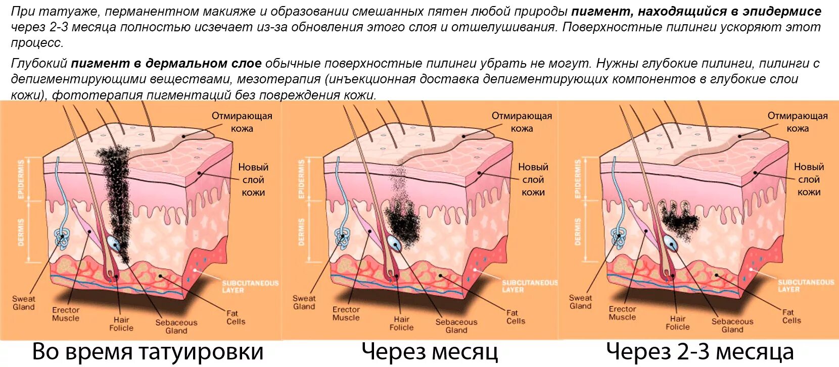 Распад кожи. Глубина введения пигмента в кожу. Заживление кожи пигмент. Внедрение пигмента в кожу.