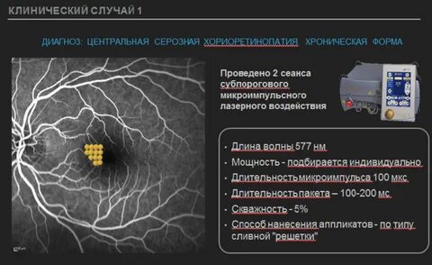 Диагноз центральный
