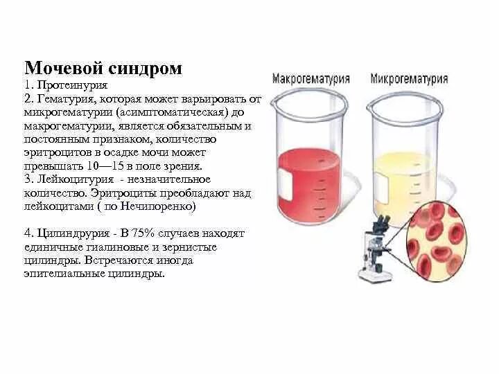 Кровь у мужчины из мочевого. Протеинурия гематурия лейкоцитурия. Микрогематурия норма эритроцитов в моче. Симптомы гематурии и протеинурии. Причины появления крови в моче.