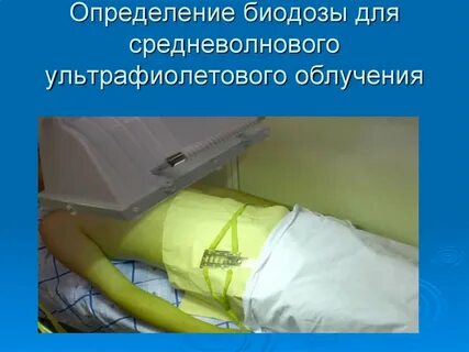 Облучение определение