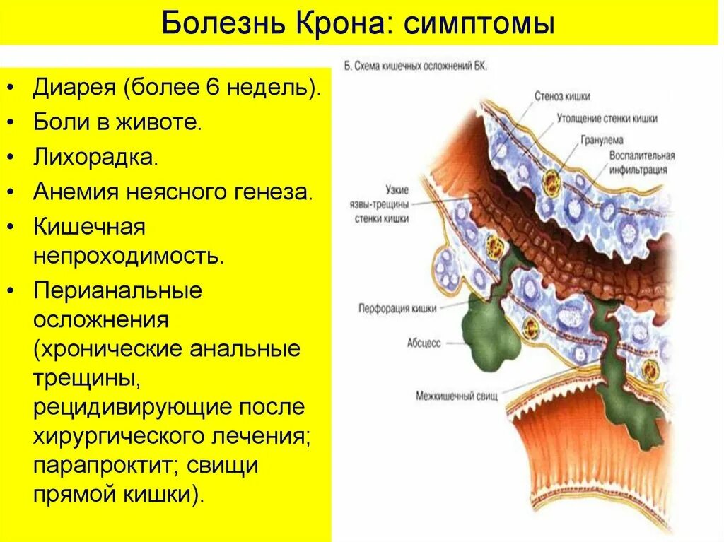 Боли в животе отзывы форум. Симптомы брлезникрона. Болезни кротона.