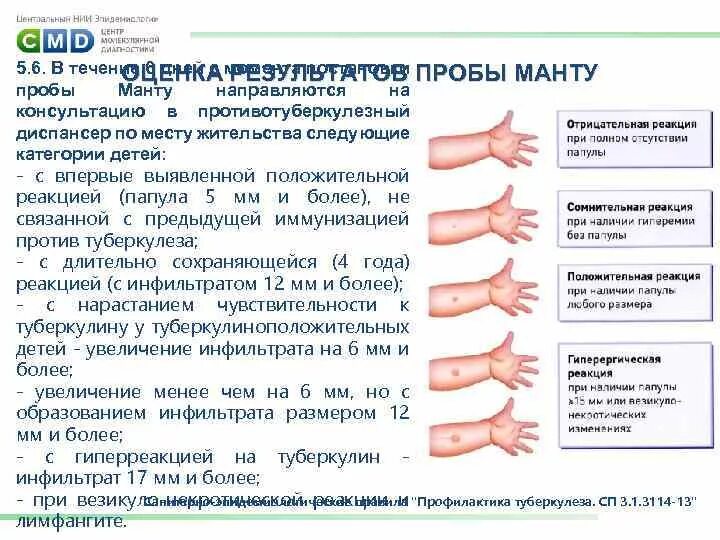 Прививка манту что нельзя делать. Туберкулинодиагностика (проба манту с 2 те). Отрицательный диаскинтест папула 10мм. Диаскинтест нормальный размер у детей 7 лет. Реакция манту 12 мм у ребенка 4 года.