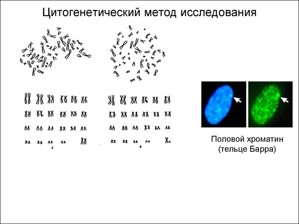 Методы генетики цитогенетический метод. Цитогенетический метод наследственности человека. Цитогенетический метод изучения. Цитогенетический метод исследования генетика. Цитогенетический метод наследственные заболевания