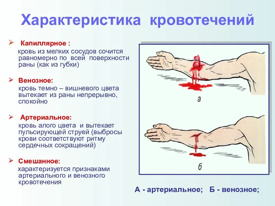 Кровотечения и их признаки. Виды кровотечений их признаки и 1 помощь. Таблица виды кровотечений признаки и первая помощь. Кровотечения диагностические критерии. Классификация кровотечений.