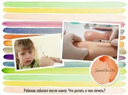 Можно ставить манту при насморке