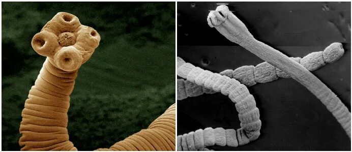 Солитер бычий цепень. Солитер бычий цепень. Ленточный червь широкий лентец. Ленточные черви бычий цепень. Солитер бычий цепень.