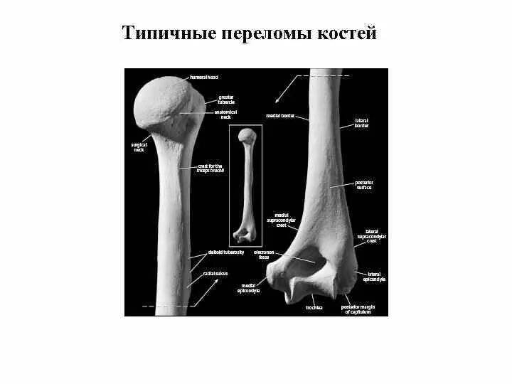 6 трубчатых костей. Отделы длинной трубчатой кости рентген. Зона роста трубчатых костей. Схема длинной трубчатой кости взрослого и ребенка. Трубчатая кость на рентгенограмме.