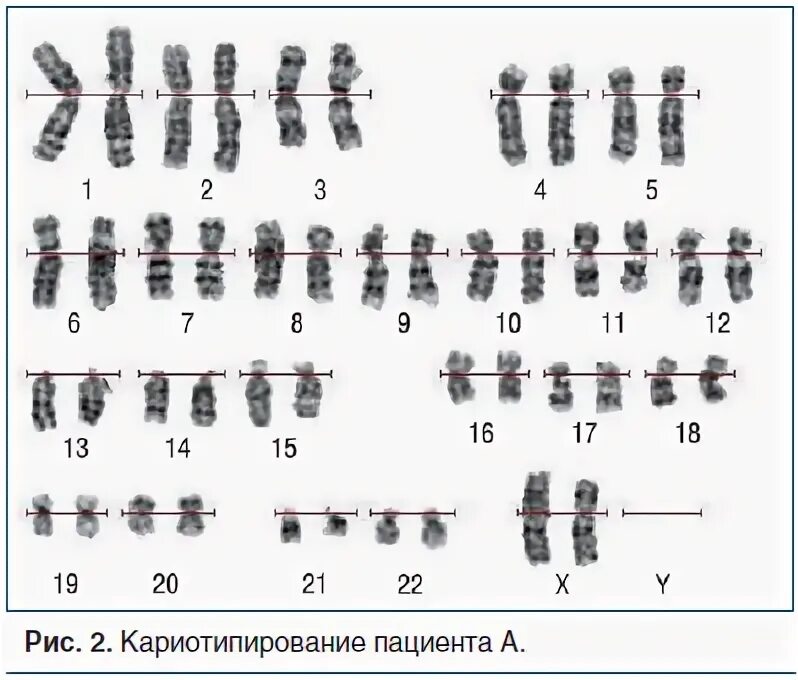 Кариотипирование супругов цена