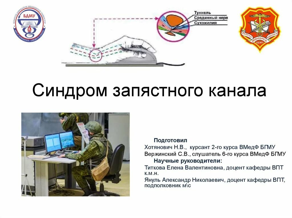 Мкб 10 синдром запястного канала. Мкб 10 синдром запястного канала