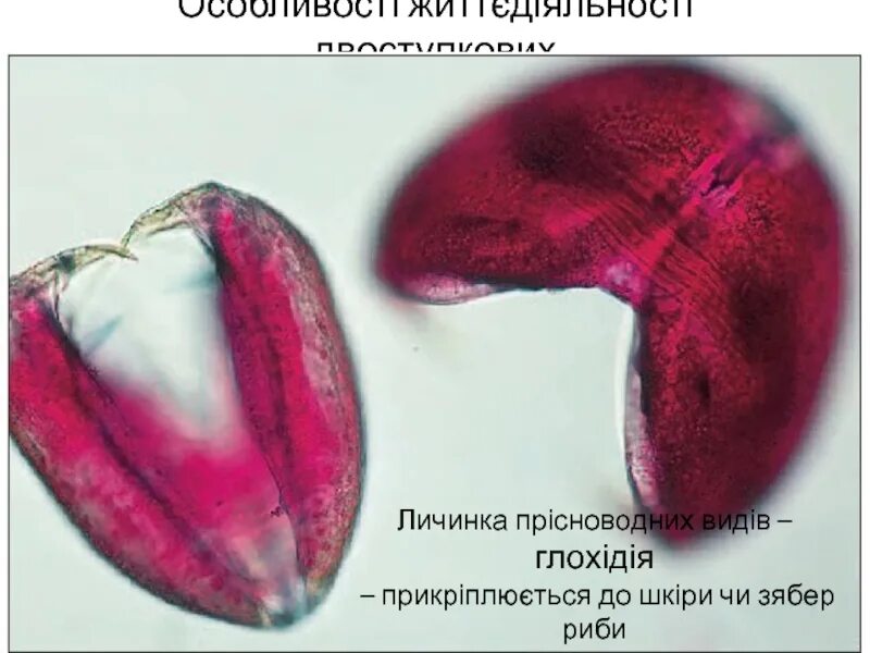 Глохидии личинки беззубки. Глохидии личинки беззубки. Строение личинки глохидии. Глохидий. Глохидий беззубки личинка строение.