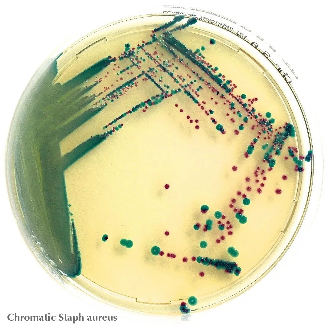 Хромогенные питательные среды. Стафилококк ауреус микробиология. Стафилококк ауреус на средах. Хромогенные среды микробиология. Staphylococcus aureus среда