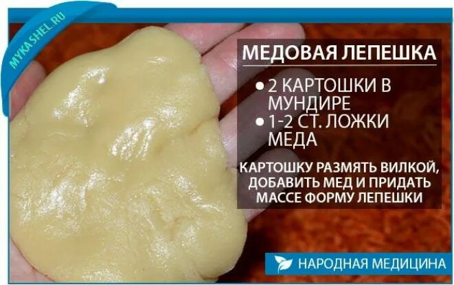 Горчичная лепешка. Лепёшка от кашля для детей. Медовая лепёшка от кашля. Медовая лепёшка от кашля для детей. Как делать лепешку от кашля ребенку.