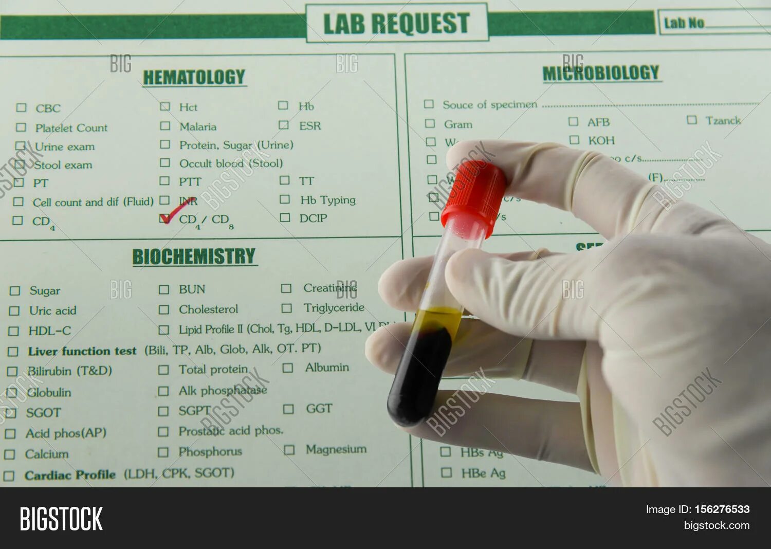 Сдать кровь на д3. Иммунология анализ. Чек платное исследование крови. Blood Chemistry Test bilirubin. Blood Chemistry Test bilirubin direct.