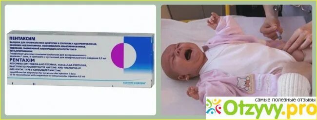 Пентаксим вакцина покраснение. Пентаксим реакция на прививку. Пентаксим реакция на прививку. Полиомиелит пентаксим схема. Пентаксим реакция на прививку.