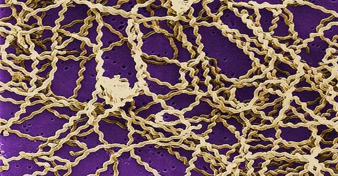 Leptospira interrogans микроскопия. Лептоспироз гистология. Лептоспироз животных патанатомия. Лептоспироз гепатит