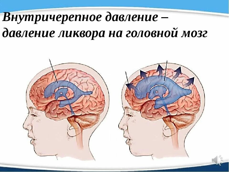 Внутричерепное давление головного мозга