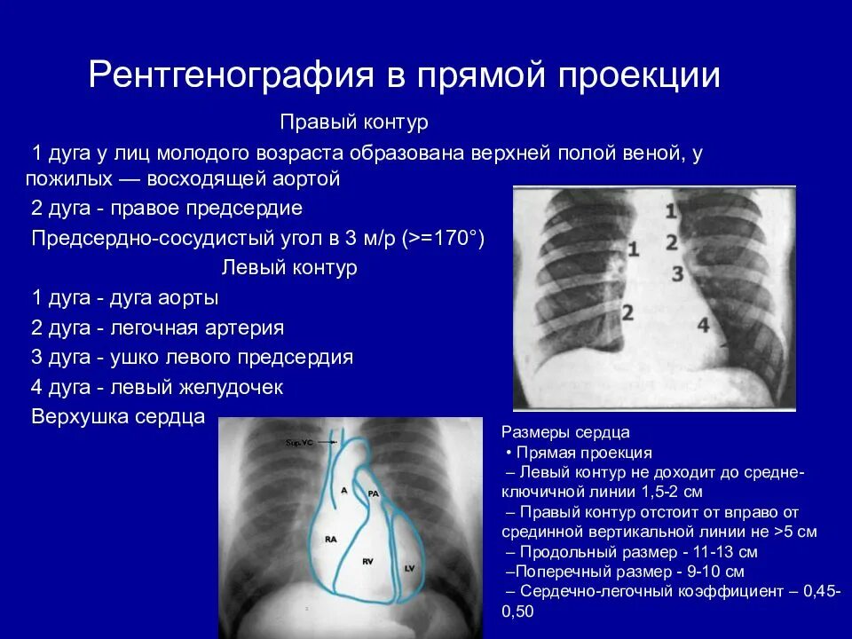 Рентген в прямой проекции