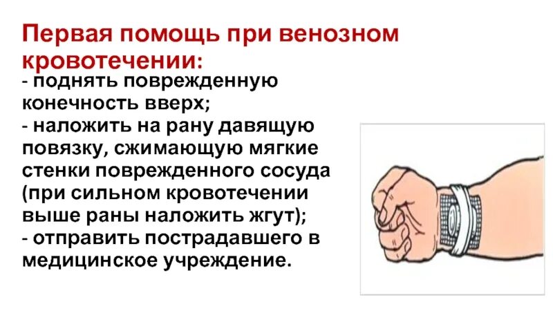 Первая помощь при венозном кровотечении. Венозное кровотечение первая помощь. Оказание первой помощи при венозном кровотечении. Алгоритм действий при венозном кровотечении.