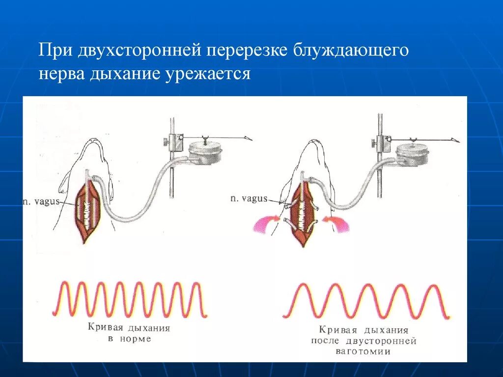 При перерезке блуждающих нервов дыхание. Перерезки физиология дыхания. Перерезание блуждающего нерва при дыхании. Нервный выдох.