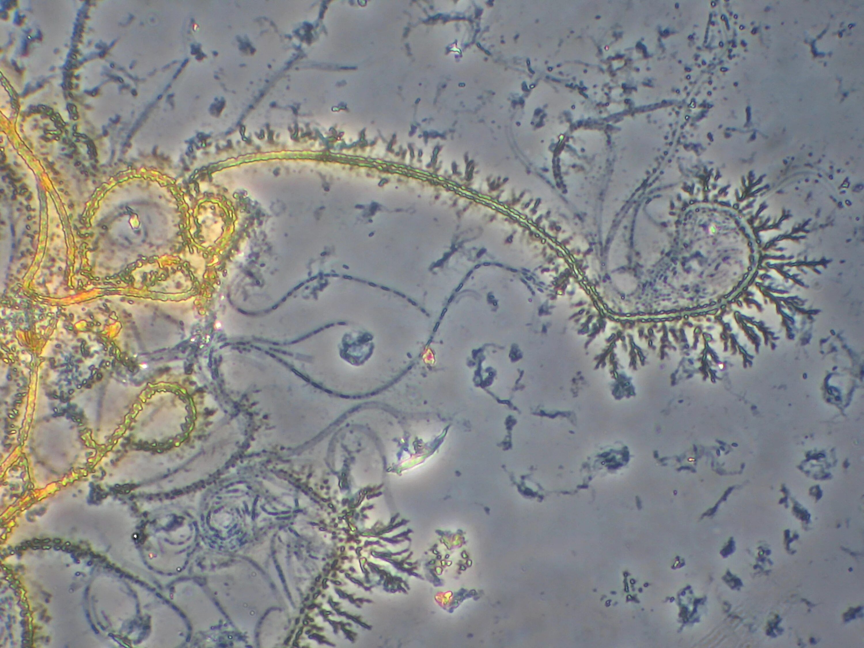 Лептотрикс лечение. Лептотрикс микроскопия. Leptothrix ochracea. Leptothrix бактерии.