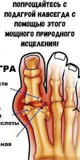 Миндаль при подагре