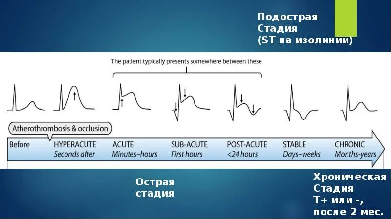 Умеренные неспецифические изменения. Неспецифические изменения St. St на изолинии. Изменения St-t. Неспецифичных изменений St-t.