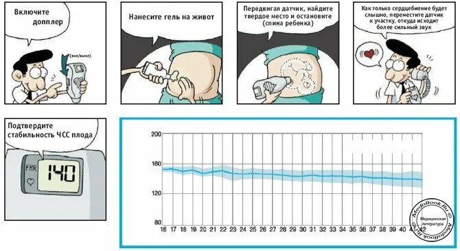 Доплер на каком сроке. Как найти сердцебиение плода доплерлм. Схема фетального Доплера. Как использовать фетальный допплер. КПЕ исподьзовать фетальный доплер.