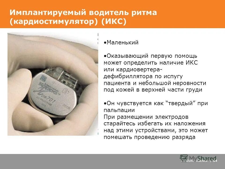кардиостимулятор сердца плюсы и минусы отзывы пациентов