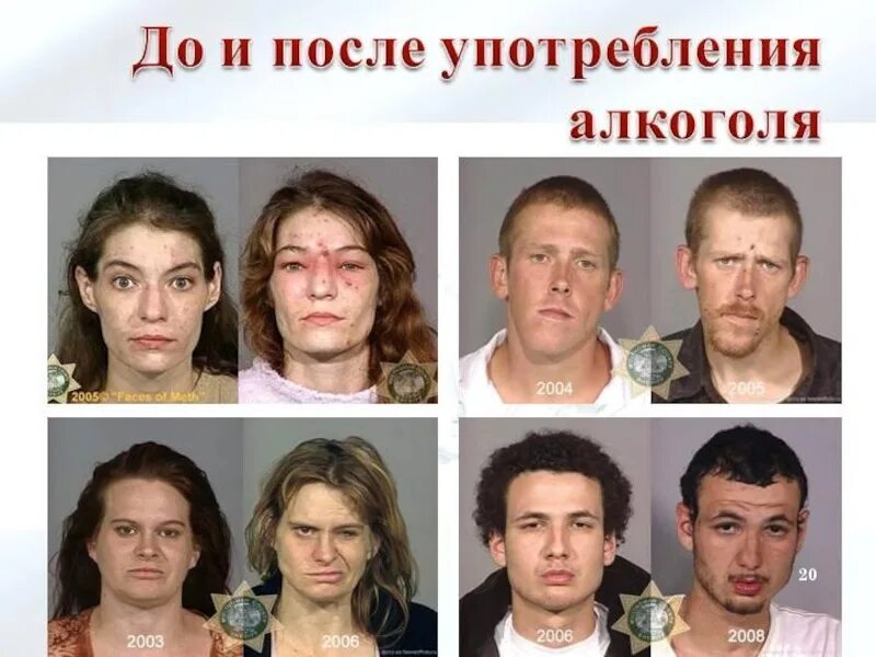 Последствия наркологии