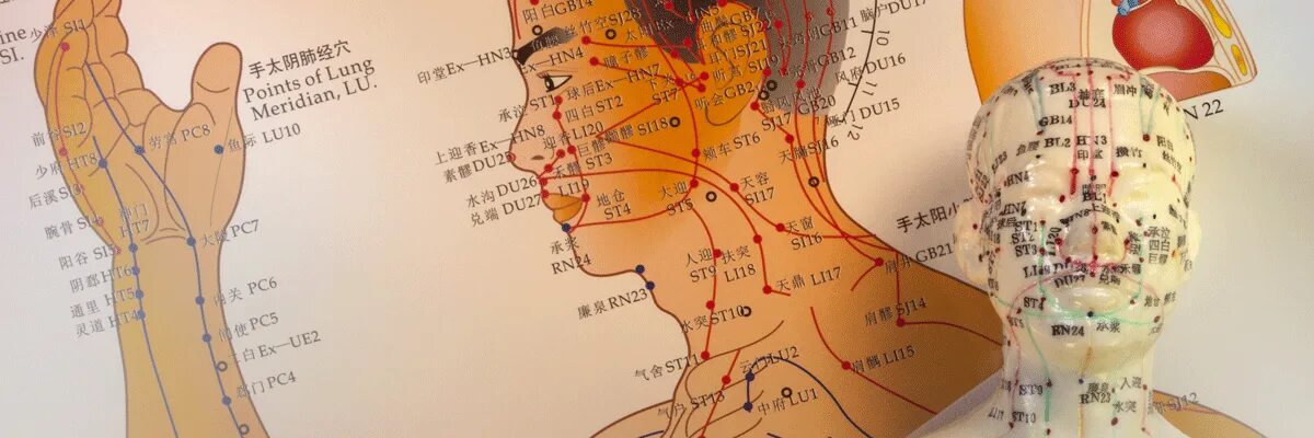 Китайская медицина синдромы. Китайская медицина синдромы. Синдромы в китайской медицине. Китайская медицина синдромы. Традиционная китайская медицина иглоукалывание.