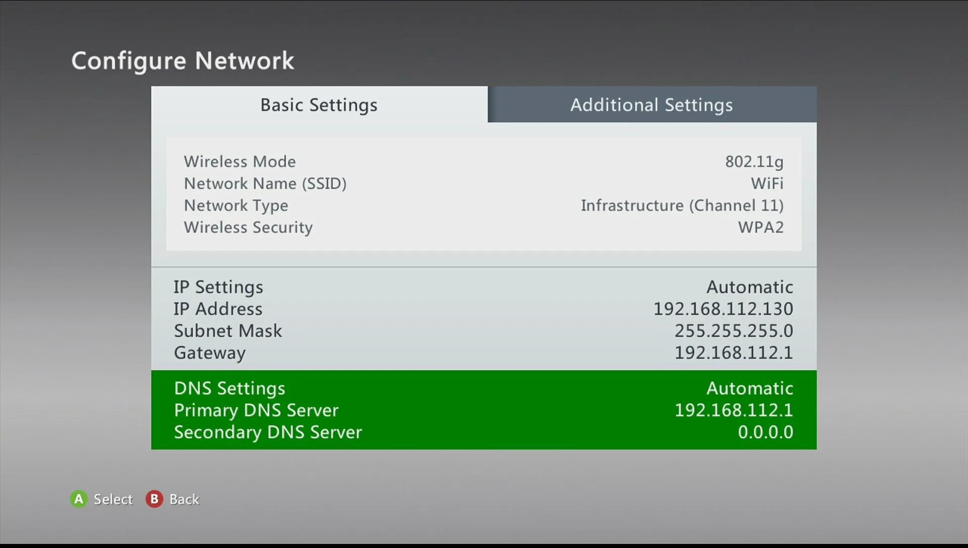 Сервер хбокс. DNS для Xbox. Сервера Xbox. IP консоли Xbox. DNS Xbox one.