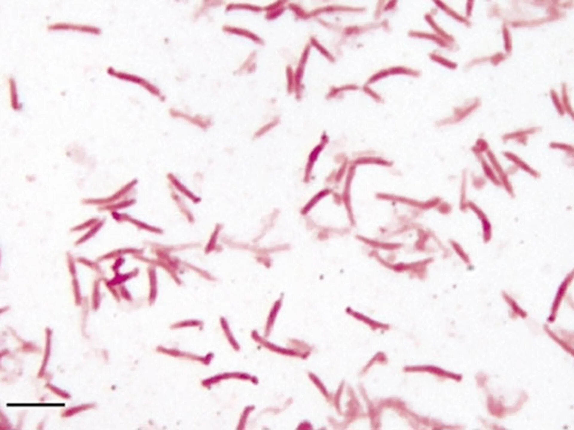 Bacteroides spp что это