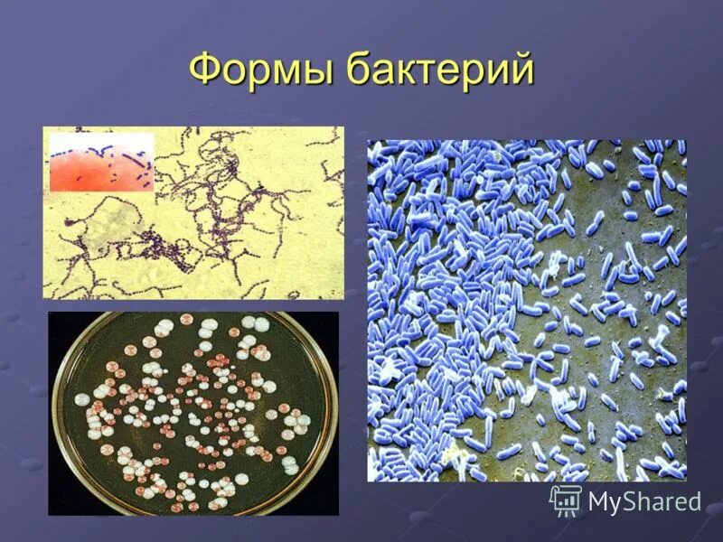 Среди бактерий встречаются. Бактерии. Разнообразие микроорганизмов. Формы микроорганизмов. Виды бактерий.