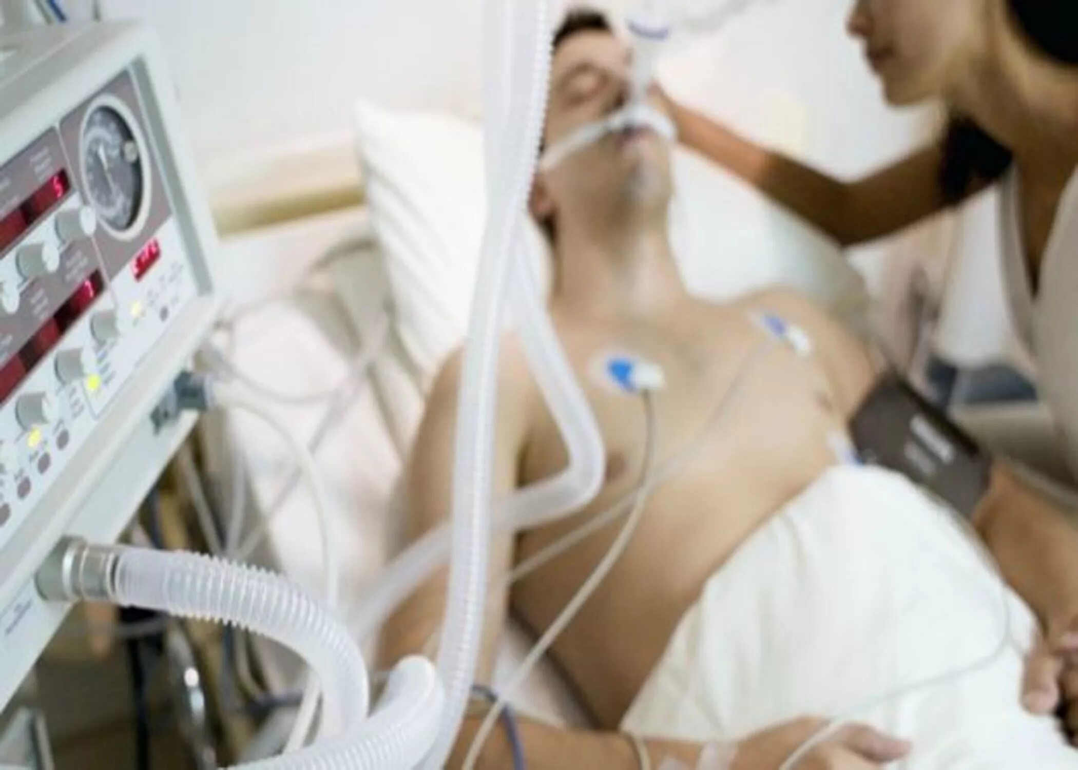 Первая кома техника