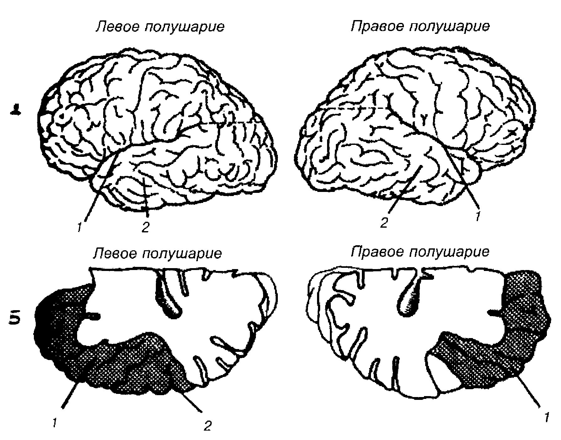 Левая гемисфера мозга. Сильвиева борозда мозга. Сильвиева борозда разделяет мозг на. ЭЭГ-проявления функциональной межполушарной асимметрии мозга. Анатомическая асимметрия коры головного мозга.