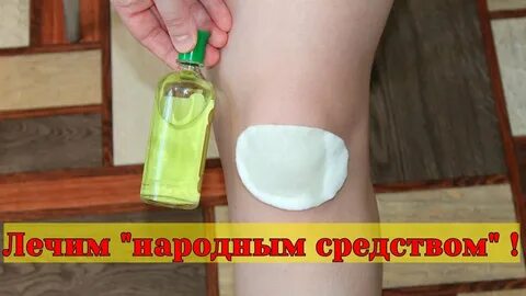Компресс на колени при артрозе