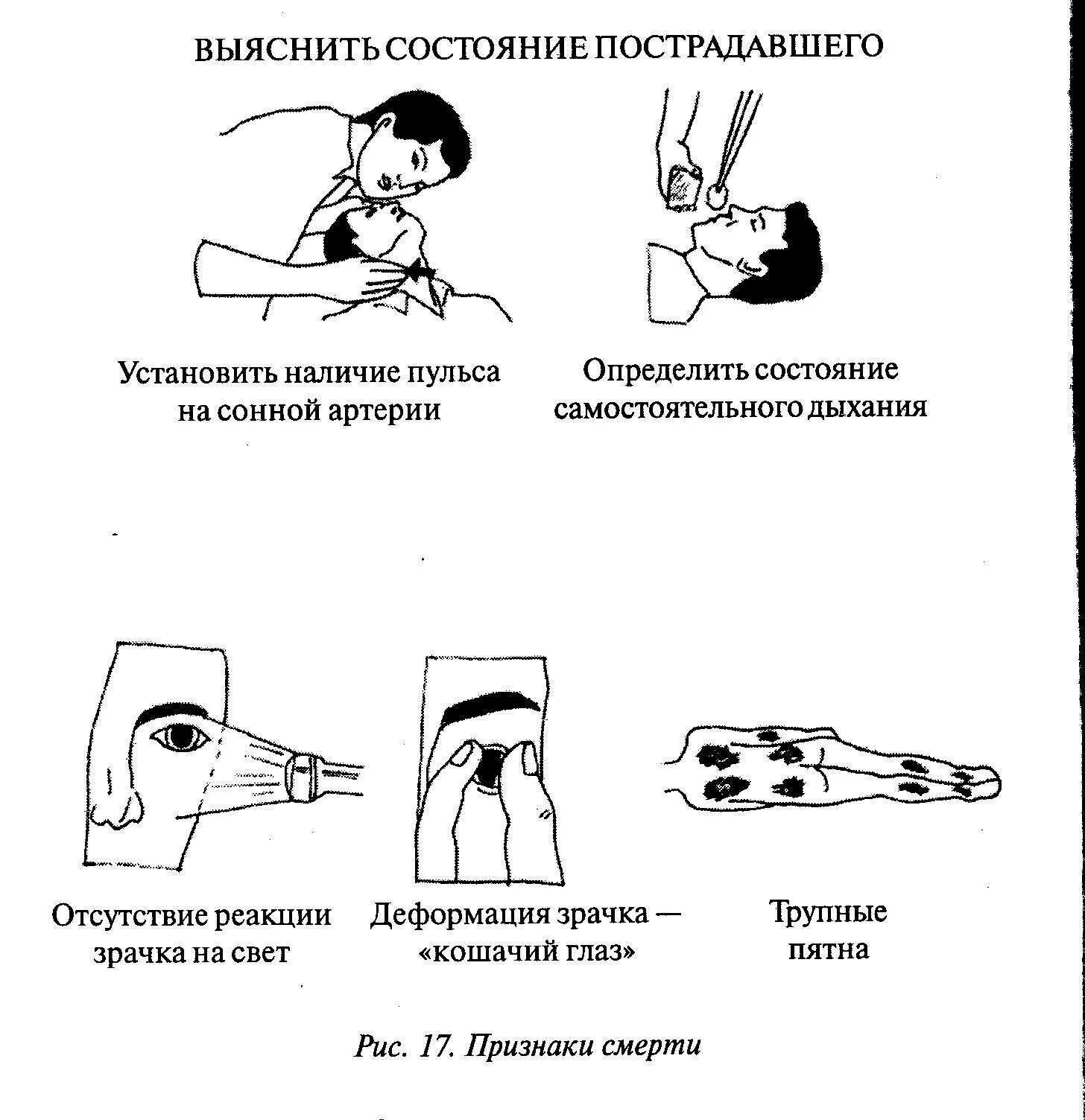 Что относится к признакам жизни пострадавшего. Определение наличия признаков жизни у пострадавшего. Терминальные состояния и оценка тяжести состояния пострадавшего. Признаки определения состояния пострадавшего. Признаки для определения состояния здоровья пострадавшего.