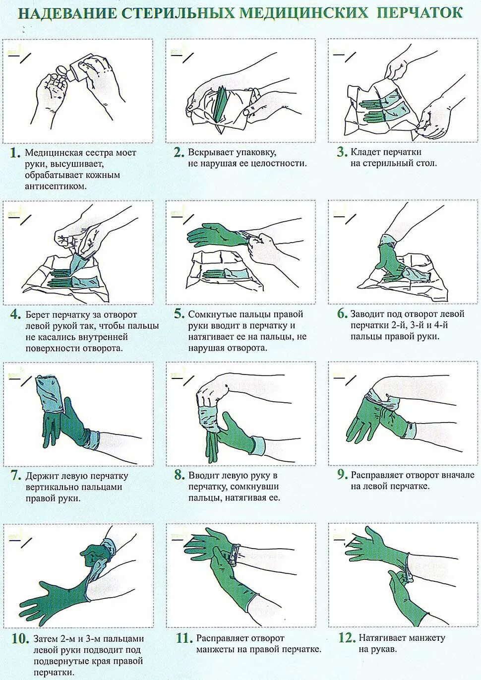 Стерильные перчатки алгоритм. Правильное одевание стерильных перчаток. Одевание стерильных перчаток алгоритм. Техника одевания стерильных перчаток алгоритм. Схема одевания стерильных перчаток.
