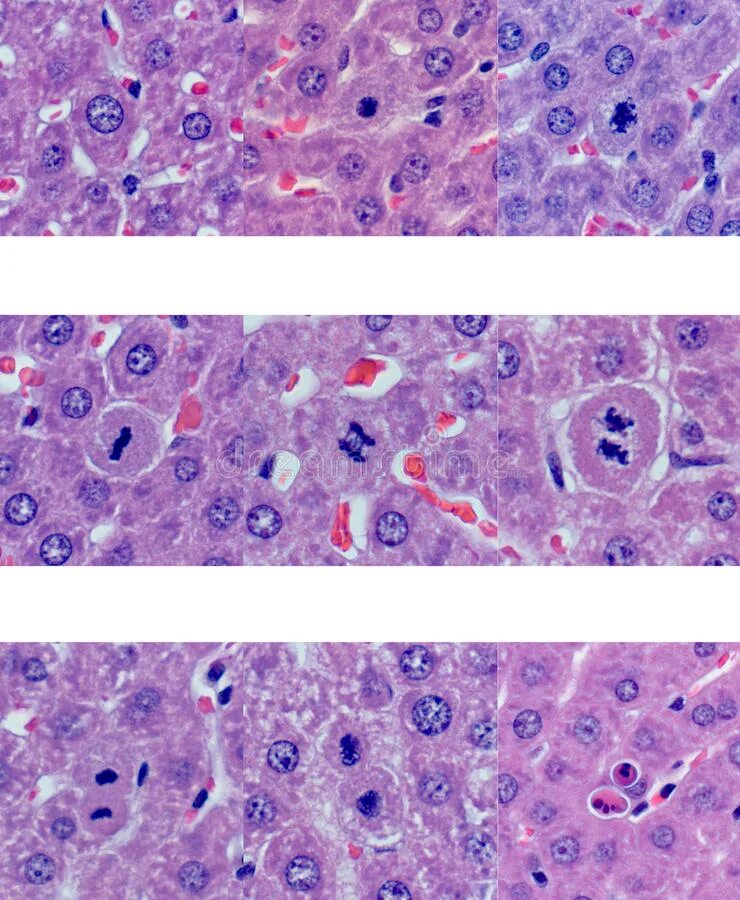 Клетки печени крыс. Митоз животной клетки краевая зона печени аксолотля. Препарат митоз животной клетки краевая зона печени аксолотля. Митоз в краевой зоне печени аксолотля. Митоз в краевой зоне печени препарат.