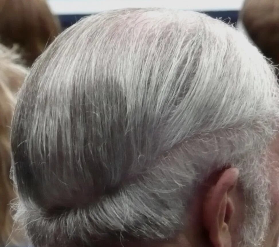 Волосы зализанные на лысину. Скрытие лысины. Причёски с лысиной на макушке для мужчин. Как скрыть лысину. Как скрыть лысину.