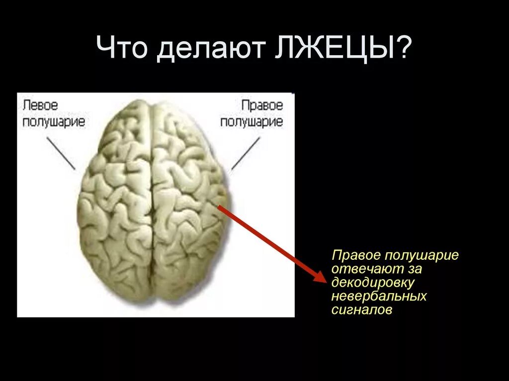 Болит левое мозг. Болит левое полушарие. Болит левое полушарие мозга. Что если болит левое полушарие головы. Ноет левое полушарие головы.