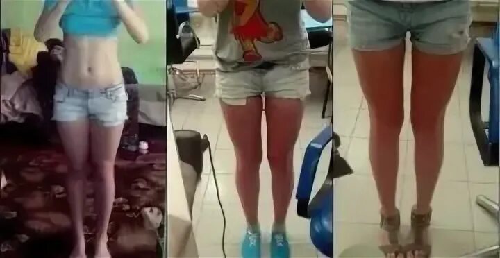 Почему худеют ноги