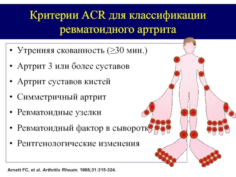 Суставы наиболее часто поражаются при