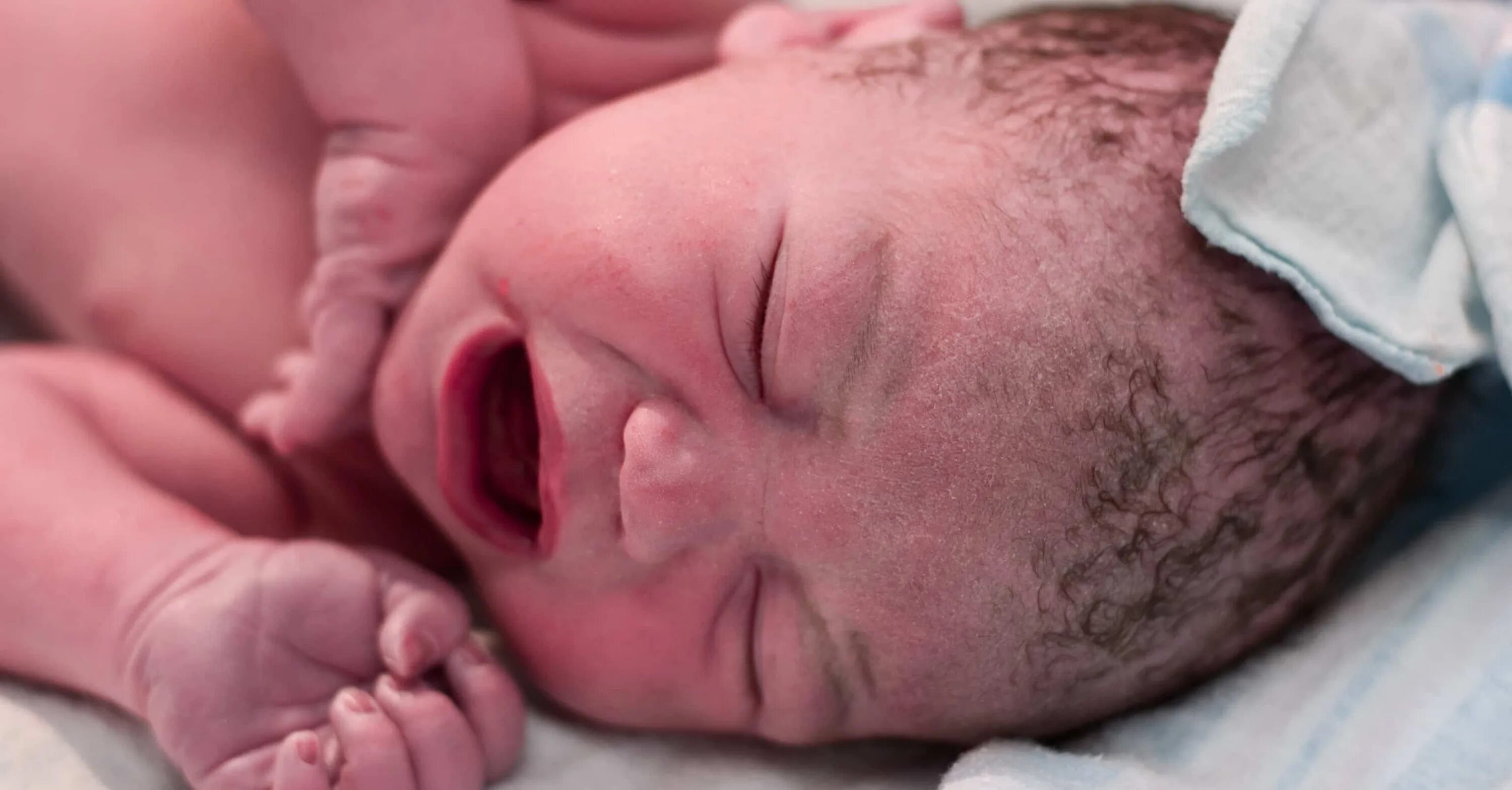 Переношенный новорожденный. Новорожденный ребенок плачет. Кожа переношенного новорожденного.