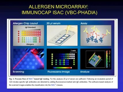 Ige immunocap