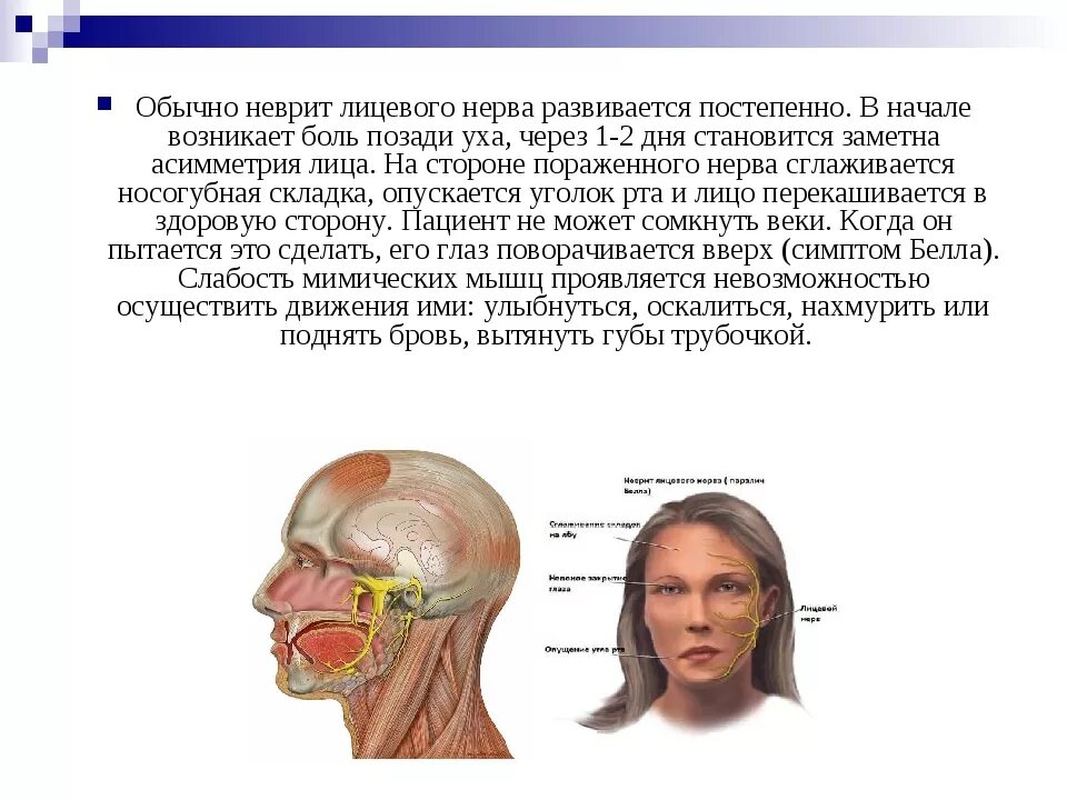 Реабилитация лицевого нерва. Клинические проявления при неврите лицевого нерва. При неврите лицевого нерва страдают мышцы :. Неврит лицевого нерва тактика фельдшера. Основной синдром при неврите лицевого нерва:.