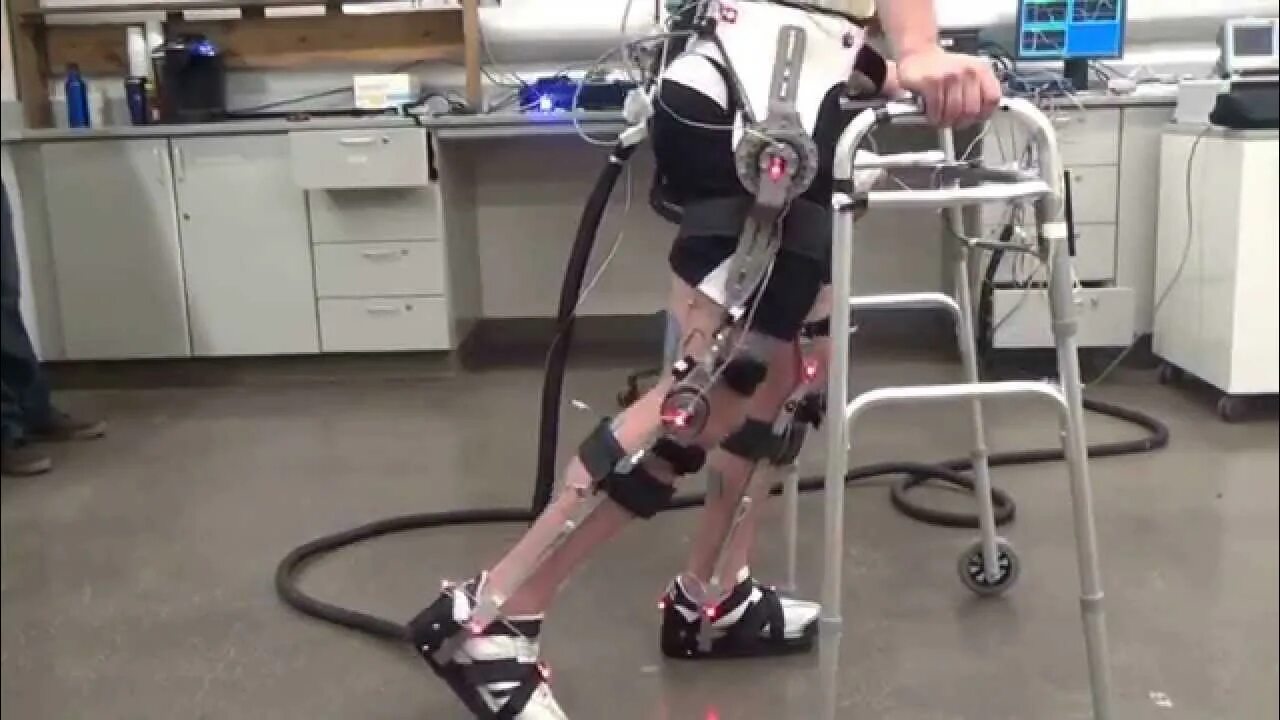 Инвалид после инсульта 1 группа. Bionx протезы. Протез ноги. Бионический протез ноги. Роботизированные протезы.