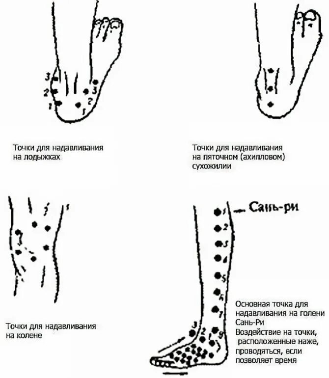 Какие точки надо массировать. Постановка пиявок на голеностопный сустав схема. Схема постановки пиявок на стопу. Пиявки на колено схема постановки. Постановка пиявок на коленный сустав схема.